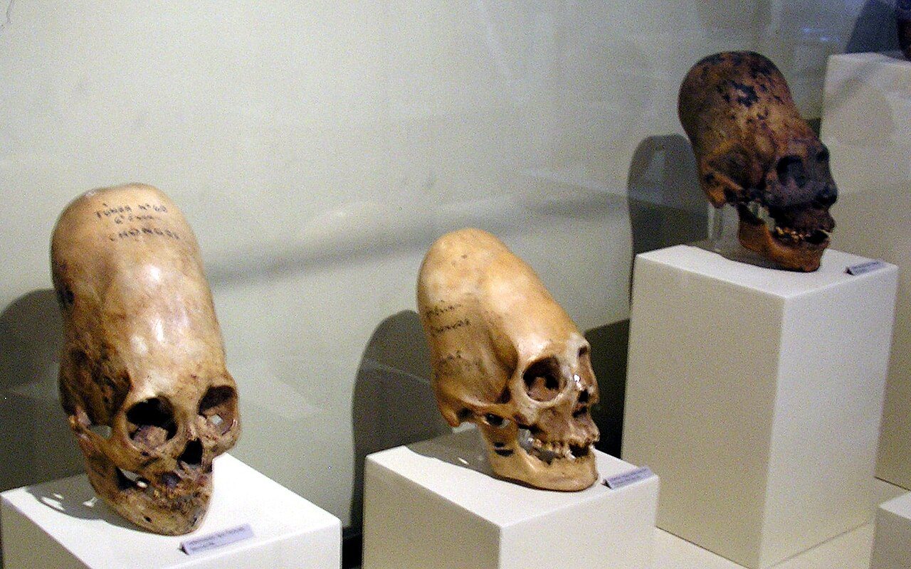 The Paracas skulls — Peru